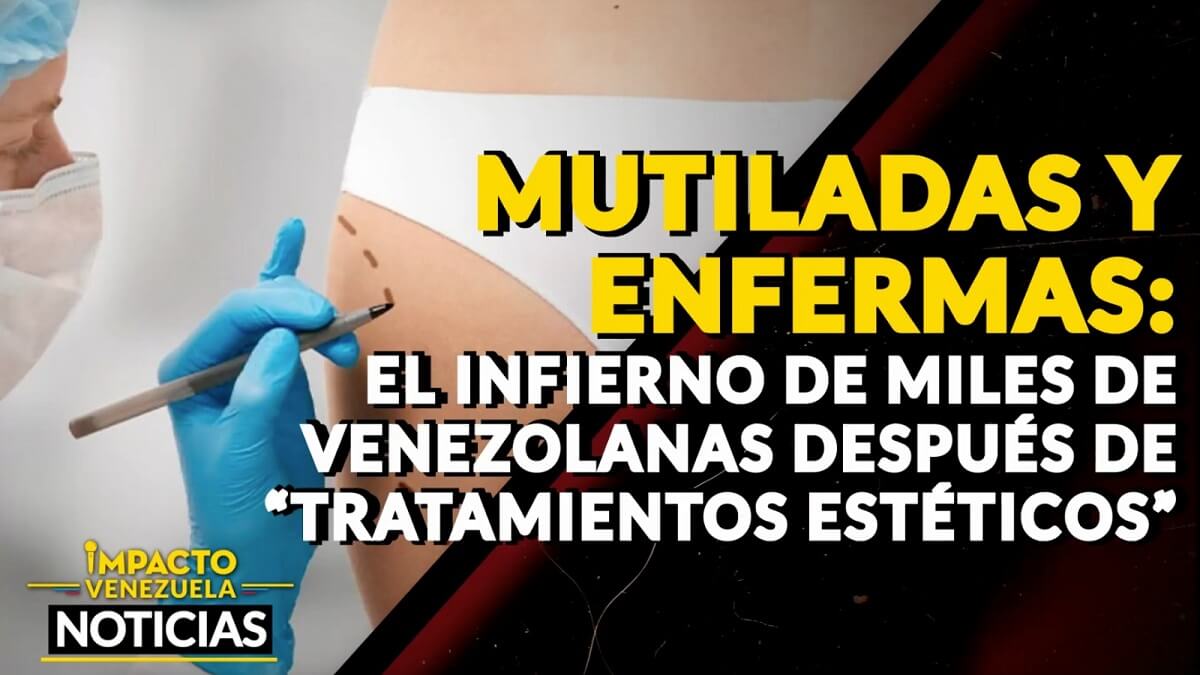 MUTILADAS Y ENFERMAS: el infierno de miles de venezolanas después de “tratamientos estéticos” – VIDEO