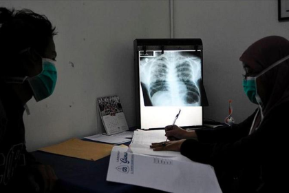 Alarmante aumento de casos de tuberculosis en Margarita