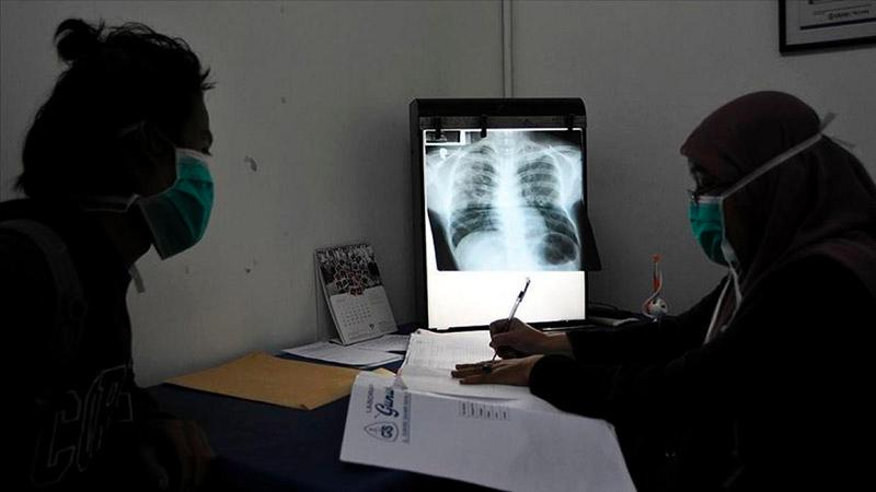 Alarmante aumento de casos de tuberculosis en Margarita