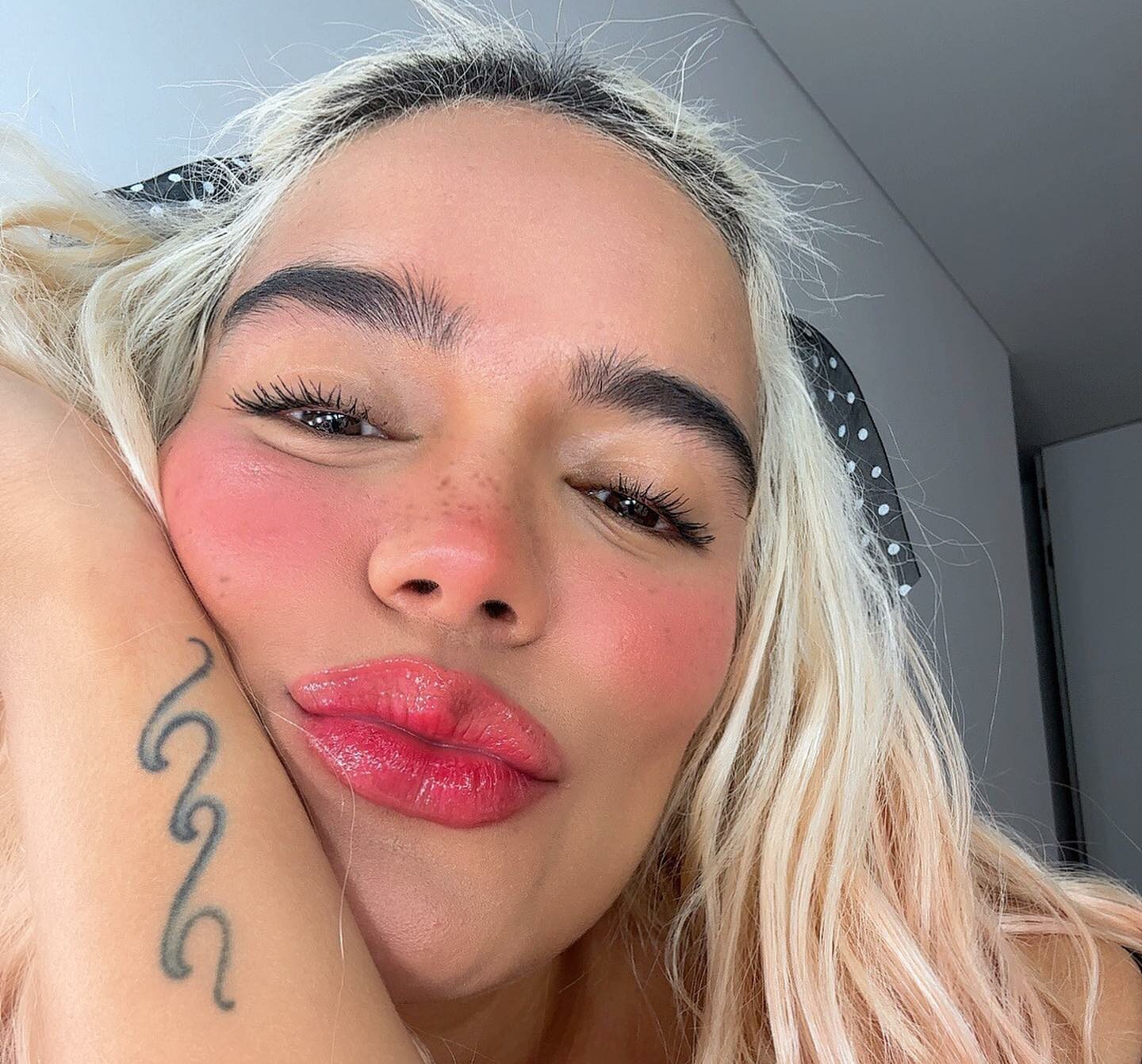 Karol G comparte detalles sobre su desafío hormonal y cómo lo está superando