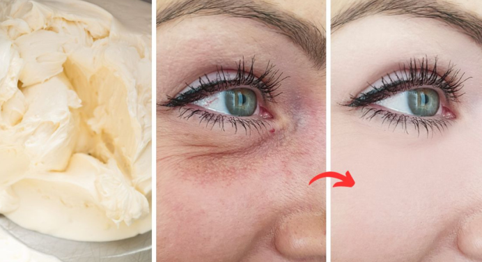 ¡Elimina ojeras y arrugas con esta crema casera! Hazlo tu misma