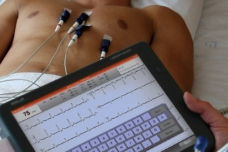 Nueva Esparta: Curso de electrocardiografía práctica los días 18 y 19 de mayo