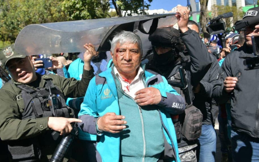 El alcalde lamentó la actitud de los manifestantes y criticó que, a pesar de las diferencias políticas, se recurra a la violencia y al vandalismo.