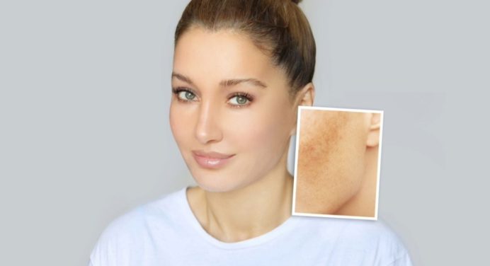 El jugo rico en vitamina A que te ayudará a eliminar por completo las manchas del rostro