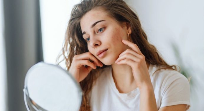 Tips para un cutis radiante en otoño y decir adiós a la piel reseca
