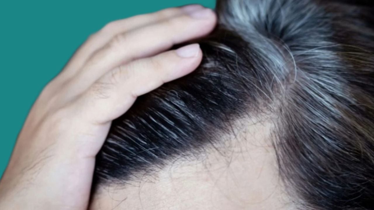 El truco definitivo con ingredientes de cocina para acabar con las canas prematuras del cabello