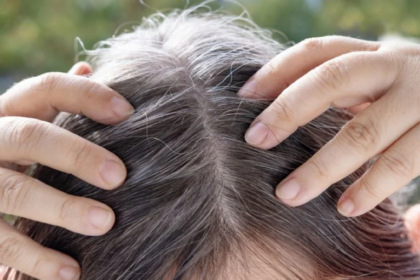 Las canas aparecen por la pérdida de pigmentación en el cabello como así también la disminución de melanina, que es el pigmento que le da el color no solo a la piel sino al cuero cabelludo.