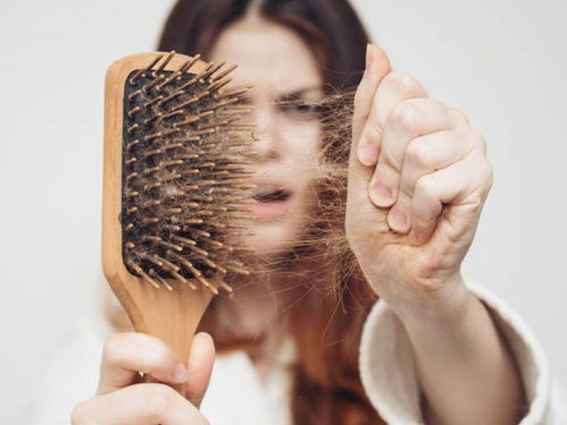 Existen algunos tratamientos que por suerte colaboran con la caída del cabello y que sí funcionan.