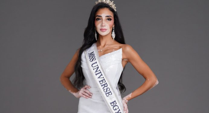 Esta es la primera candidata que tiene el Miss Universo con vitiligo