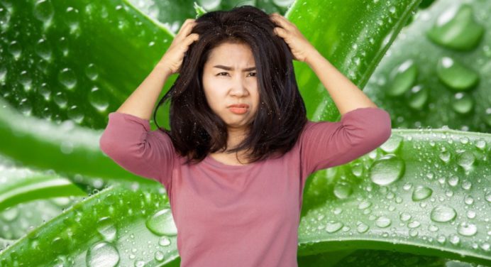Adiós caspa: el aloe vera contra la resequedad invernal del cabello