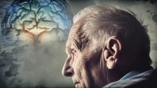 Alzheimer: ¿Por qué los casos siguen en aumento y qué podemos hacer para prevenirlo?